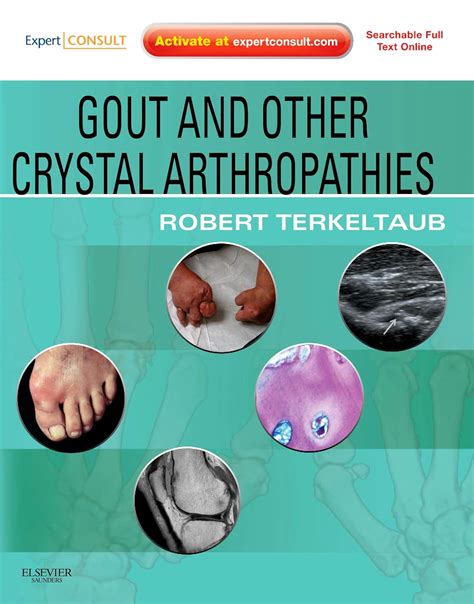 gout other crystal arthropathies gout other crystal arthropathies PDF